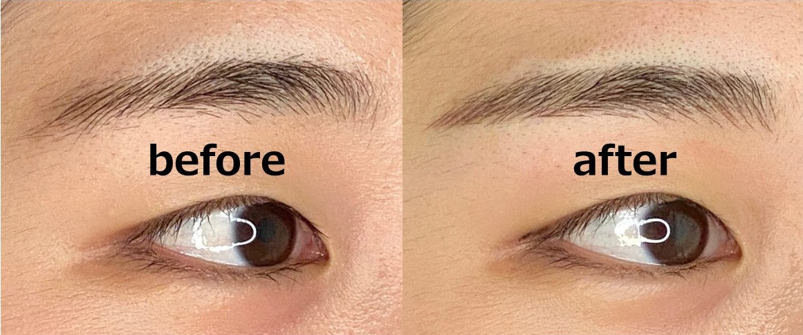 ビフォアーアフター