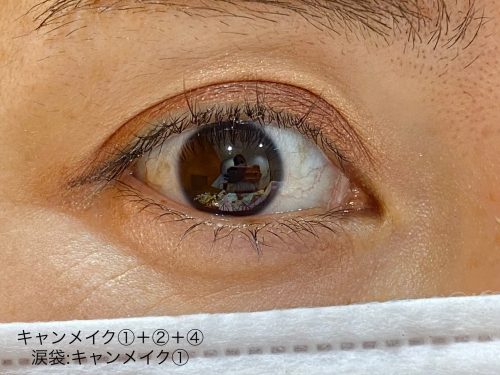 シルキースフレアイズ