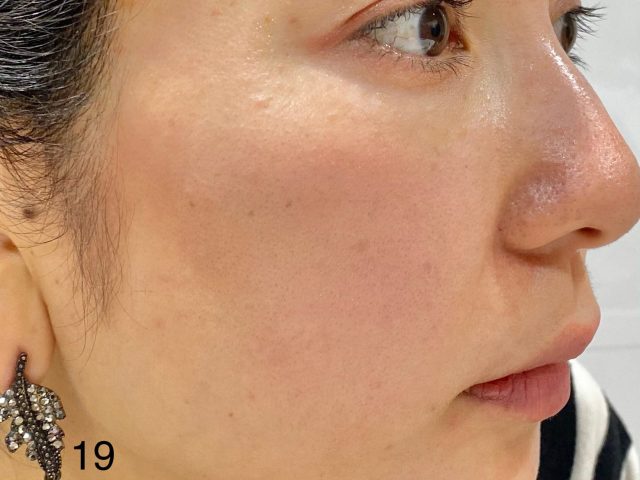 ナチュラル チークN