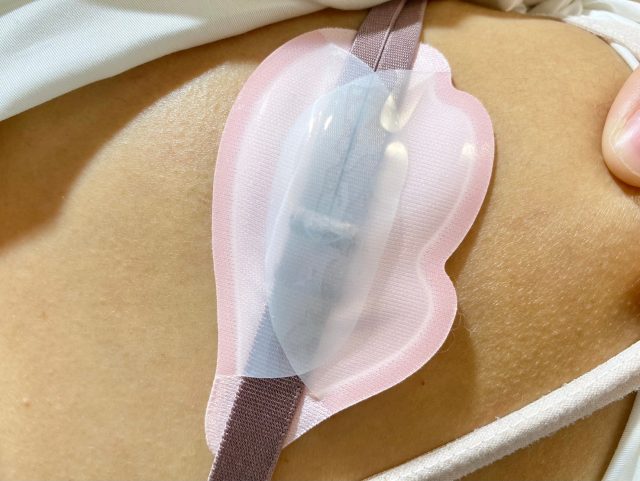 ピップエレキバンインナークリップ