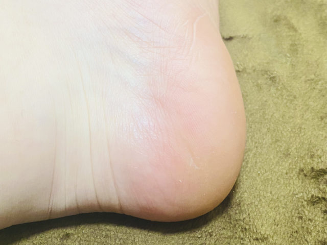 「かかとすっきりブラシ」を使った後のかかと