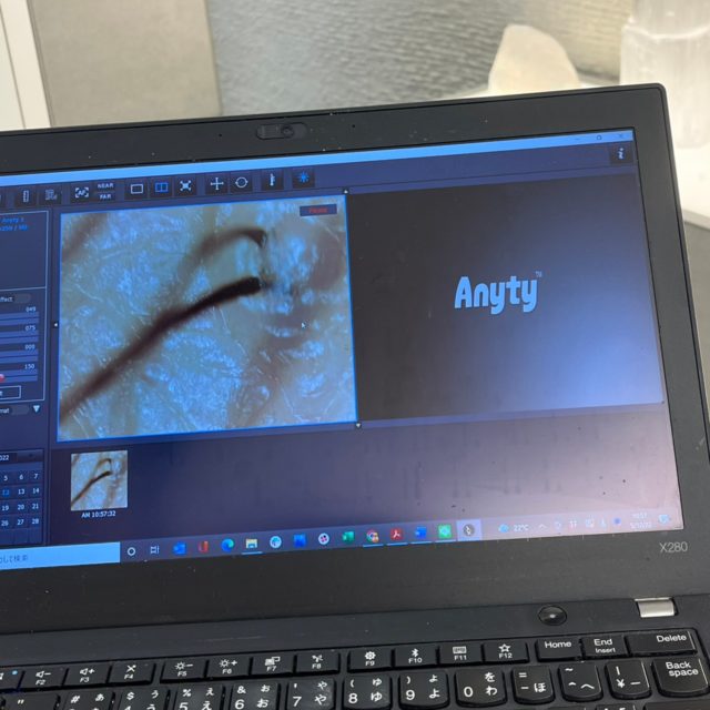 マイクロスコープモニターで確認