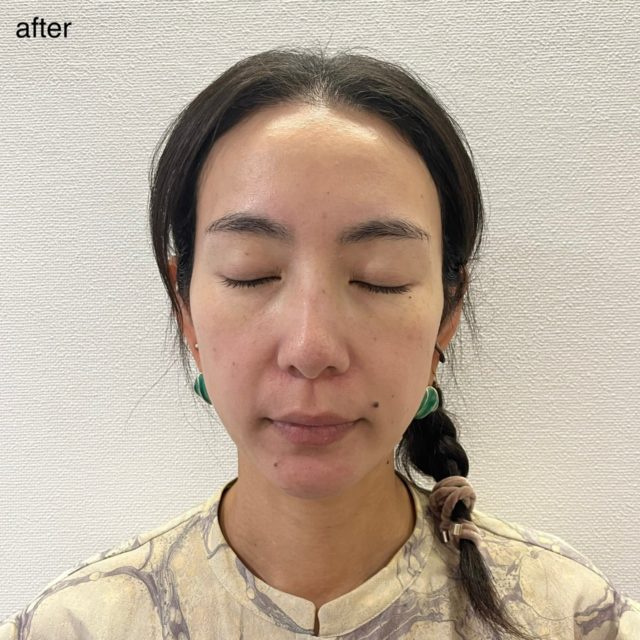 オールデイ ディープクリーンフォームの写真