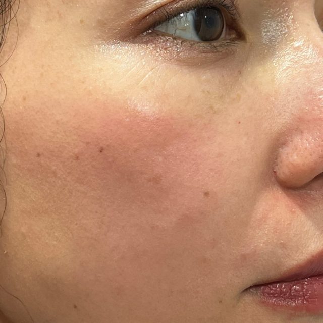 upinkのアイテム